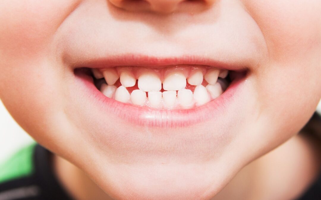 Why Fluoride-Free Water Is Bad for Teeth