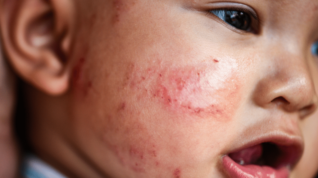 Maintaining Healthy Baby Skin: Essential Skincare Tips